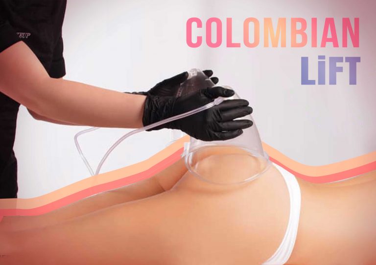 Grossir les fesses avec le Lifting Colombien