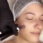 Formation-Microneedling